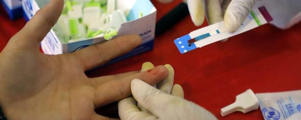 Aumentan casos de VIH en adolescentes