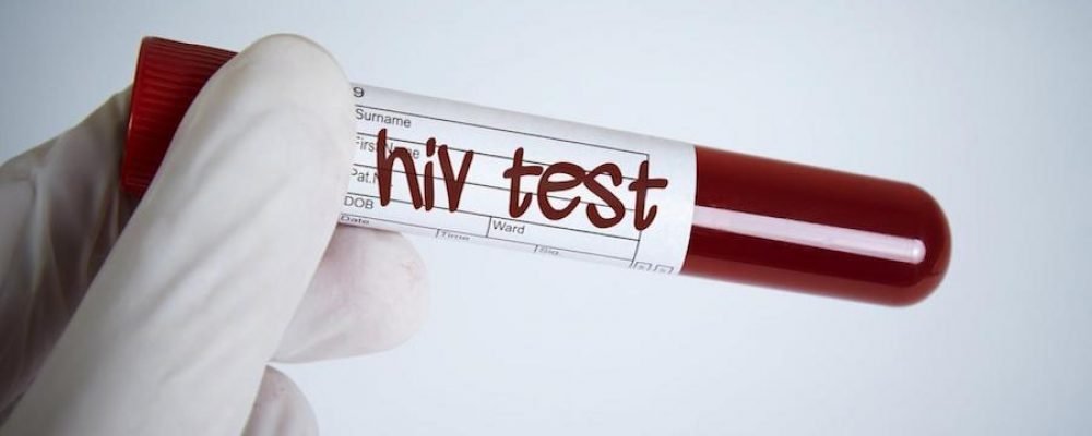 Coronavirus: que lecciones nos dejó el sida, la «peor pandemia de finales del siglo XX», para hacer frente al covid-19